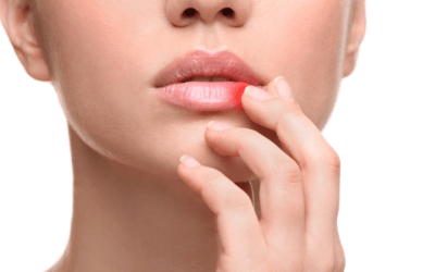 Do Lip Fillers Hurt?