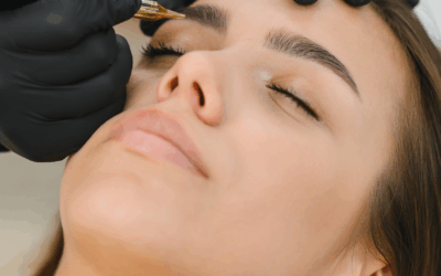 How to Treat And Remove Pigmentation